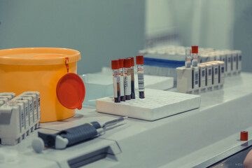 Closeup shot of medical equipment and blood samples at a lab