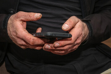 Rough Dry Skin Male Hands Using Smartphone.