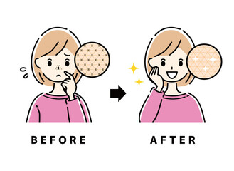 毛穴　鼻　ビフォーアフター