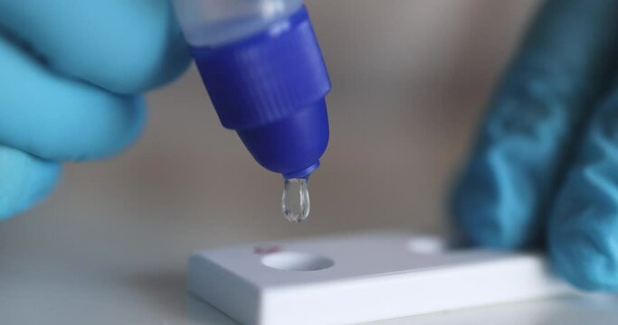 Process of express fast coronavirus covid Antigen AG PCR testing examination at home, COVID-19 swab collection kit, test tube for taking OP NP patient specimen sample, testing carried out
