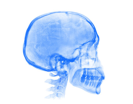 Human skull. Blue X-ray image on white background