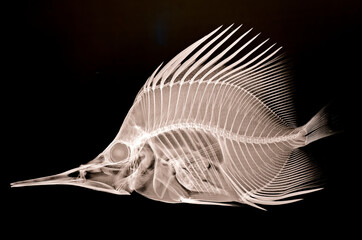 An X ray image showing the skeleton of a Long Nosed Butterfly fish.