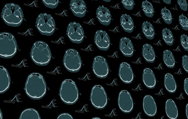 Medizinische Bilddaten eines CT oder MRT Computertomographie