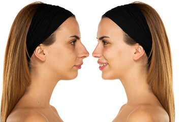 Comparison of female nose, before and after plastic surgery
