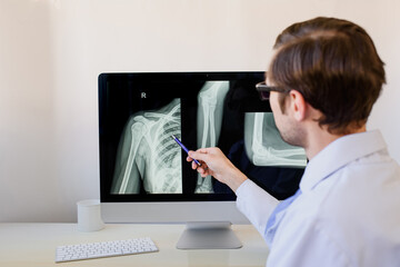 radiologist analyzing a patient arm and foream bones x ray.