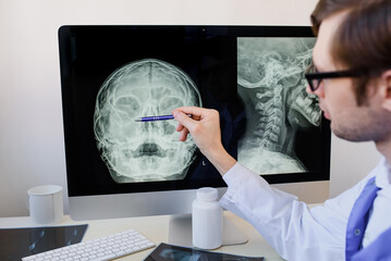 radiologist analyzing a paranasal sinus x-ray with maxillary sinusitis of a otorhinolaryngologist patient..