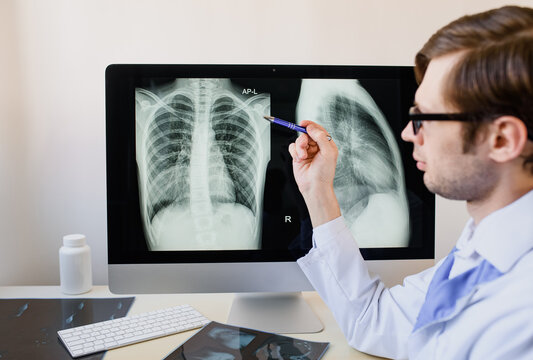 Radiologist analyzing a chest x-ray with pneumonia in right hemithorax lung.