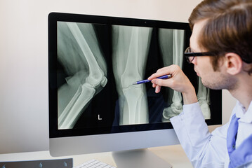 radiologist analyzing a patient knee x ray.