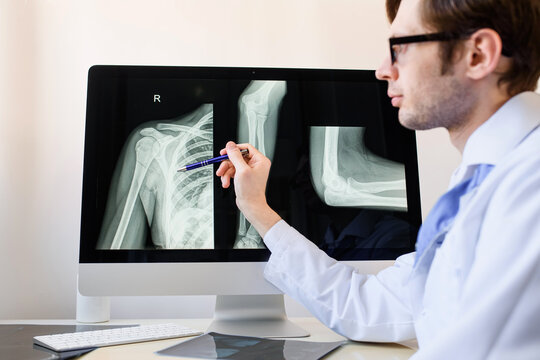 radiologist analyzing a patient arm and forearm bones x ray with a humerus fracture.