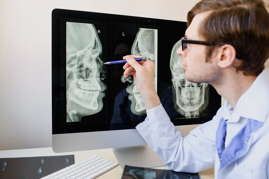 Forensic radiologist doctor analyzing a nasal bone fracture