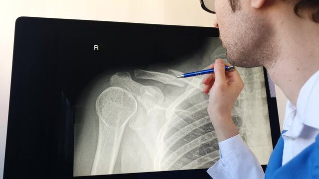 Man radiologist analysing a patient x ray with a clavicle fracture.