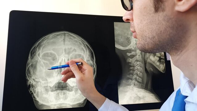 Doctor radiologist analyzing a paranasal sinus x-ray with maxillary sinusitis of a otorhinolaryngologist patient.
