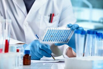 Scientist working with samples panel microplate and registering data for diseases diagnostic in the laboratory. Researcher Sample Analysis and writes down the data result of for elisa analysis