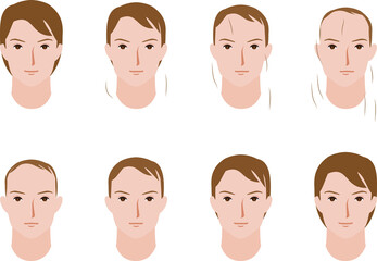 男性の毛量の増減するイラスト