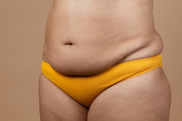 Cropped image of overweight woman with fat naked big excessive belly with navel in yellow pants. Dangling down stomach, big size tummy. Thick abdomen. Go on diet, liposuction, plastic surgery