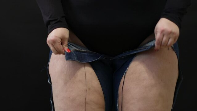 fat woman with cellulite trying to put on jeans on black background