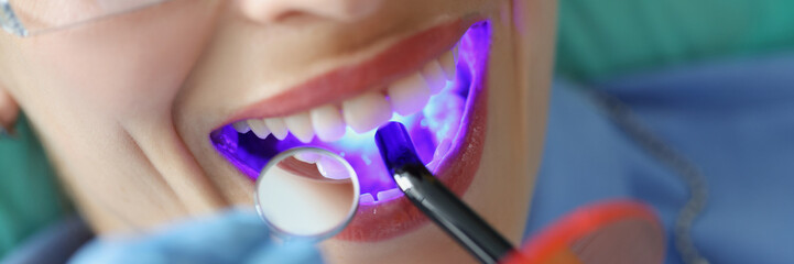 Young woman treating teeth with cordless LED curing light machine closeup