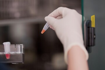 Scientist holding a urine tube for Chlamydia testing antibiotic resistance drug. Selective focus.