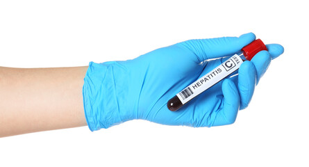 Obraz premium Scientist holding tube with blood sample and label Hepatitis C on white background, closeup