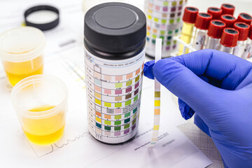 urine test, made with a vial of Urinalysis Reagent Strip used for ketosis control, laboratory...