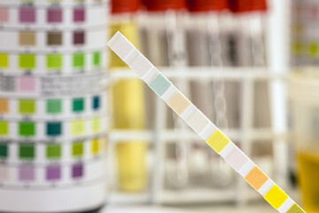 reagent strips used in urinalysis to analyze Leukocytes, Urobilinogen, Bilirubin, Blood, Nitrite,...