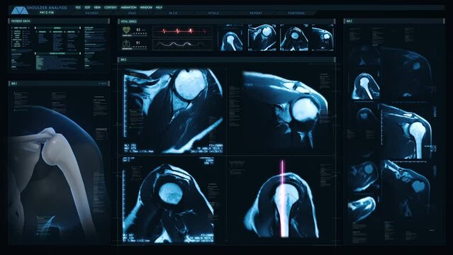 Futuristic Technological Interface Analyzing Human Anatomy. Medical Profile of Patient Showing MRI Shoulder joint or Magnetic resonance imaging of Shoulder Joint. Healthcare Information.