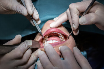 Dentist examining a patient's mouth with different tools in the operating room