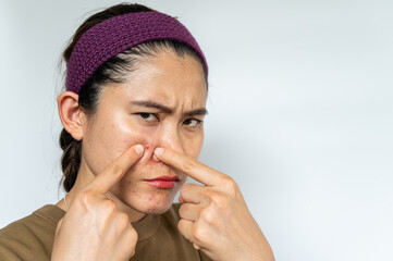 Worried Asian woman pointing to acne inflamed on her face. Inflamed acne consists of swelling,...