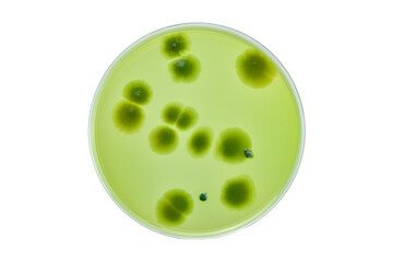 Hand with Petri dish or culture media with bacteria on white background with clipping path, Test...