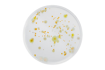 Hand with Petri dish or culture media with bacteria on white background with clipping path, Test...
