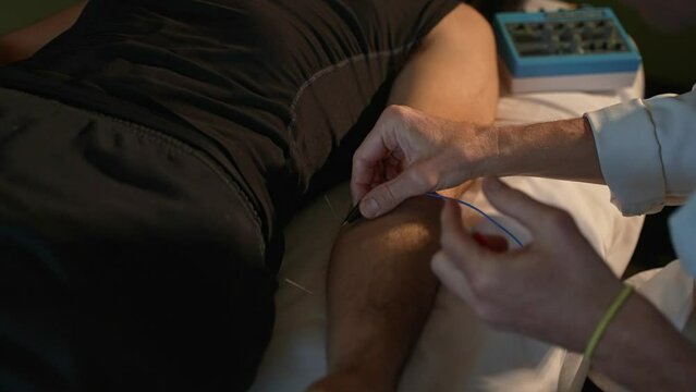 Doctor Applying Electroacupuncture Clamps To Male Patients Arm. HD Slow Motion.