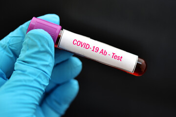 Obraz premium COVID-19 antibody test, blood sample tube for COVID-19 IgG antibody level test, after vaccination