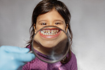 A little girl shows milk teeth with plaque and yellow spots. Children's teeth through a magnifying...