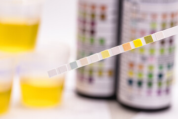 reagent strips used in urinalysis to analyze Leukocytes, Urobilinogen, Bilirubin, Blood, Nitrite,...
