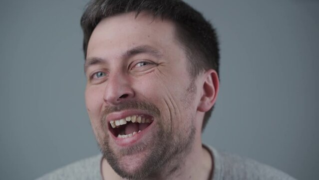 Malocclusion in young Caucasian male, crowded upper teeth. Ugly teeth with terrible smile. Close-up portrait of man with crooked teeth. Dental problem, care, toothache. Reason to install teeth braces.