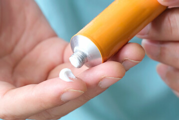 The woman's hand, she uses steroids Apply External type