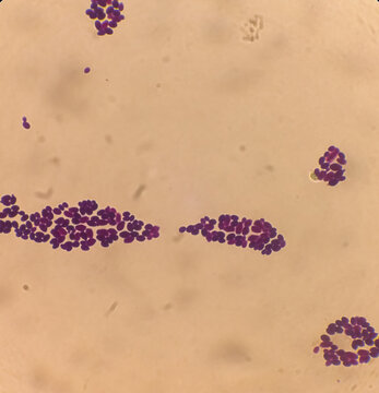 Candida spp, fungi, emerging multidrug fungus. Candida albicans, C. auris and other yeast fungi. Close up micrograph