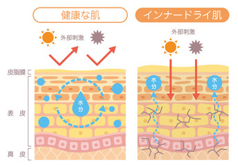肌の構造_インナードライ肌