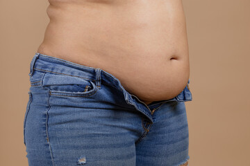 Naklejka premium Overweighted plumpy lady with flabby stomach and fat sides showing waist in unzipped jeans. Sudden weight gain. Visceral fat. Body positive. Tight little clothes. Need for wardrobe change.