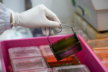 Medical scientists are staining pathological slides for pathologists to diagnose their findings.