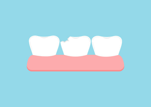 Chipped tooth in gum icon isolated on blue background. Broken teeth with problem treatment concept. Flat cartoon dentistry vector illustration. Dental health care design element.