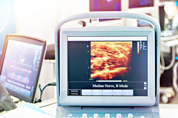 Monitor portable medical ultrasound machine