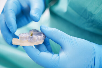 Dentist holding teeth model with metal dental implant - obrazy, fototapety, plakaty