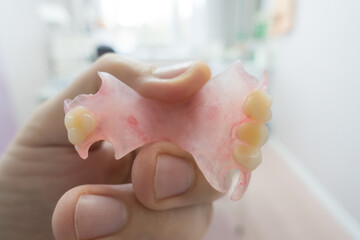 modern nylon dental prosthesis
