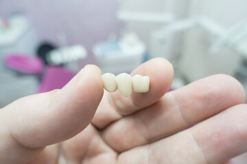 dental ceramic metal bridges in the hands