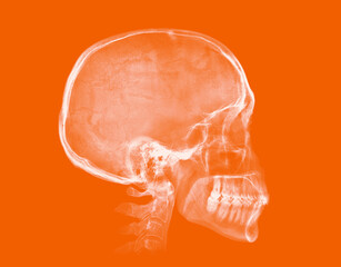 Human skull. X-ray image on orange background