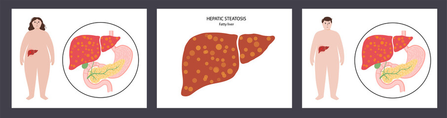 Liver disease concept