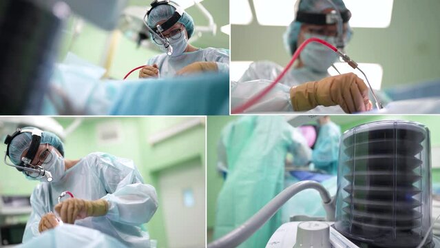 Collage. Laparoscopic instruments in action during abdominal surgery. A team of doctors cooperating while performing laparoscopic surgery in the hospital operating room