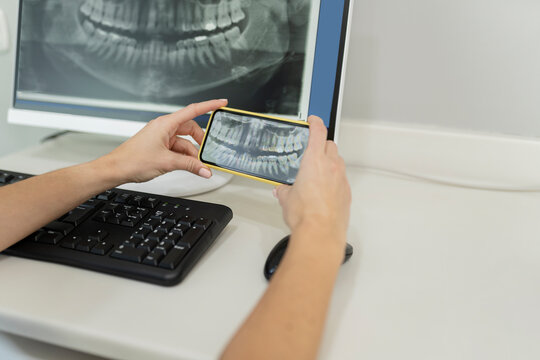 Dentist examining x-ray image through smart phone at dental clinic