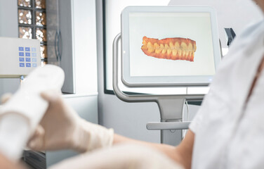 Dentist working by scanned image of teeth on monitor screen at dental clinic
